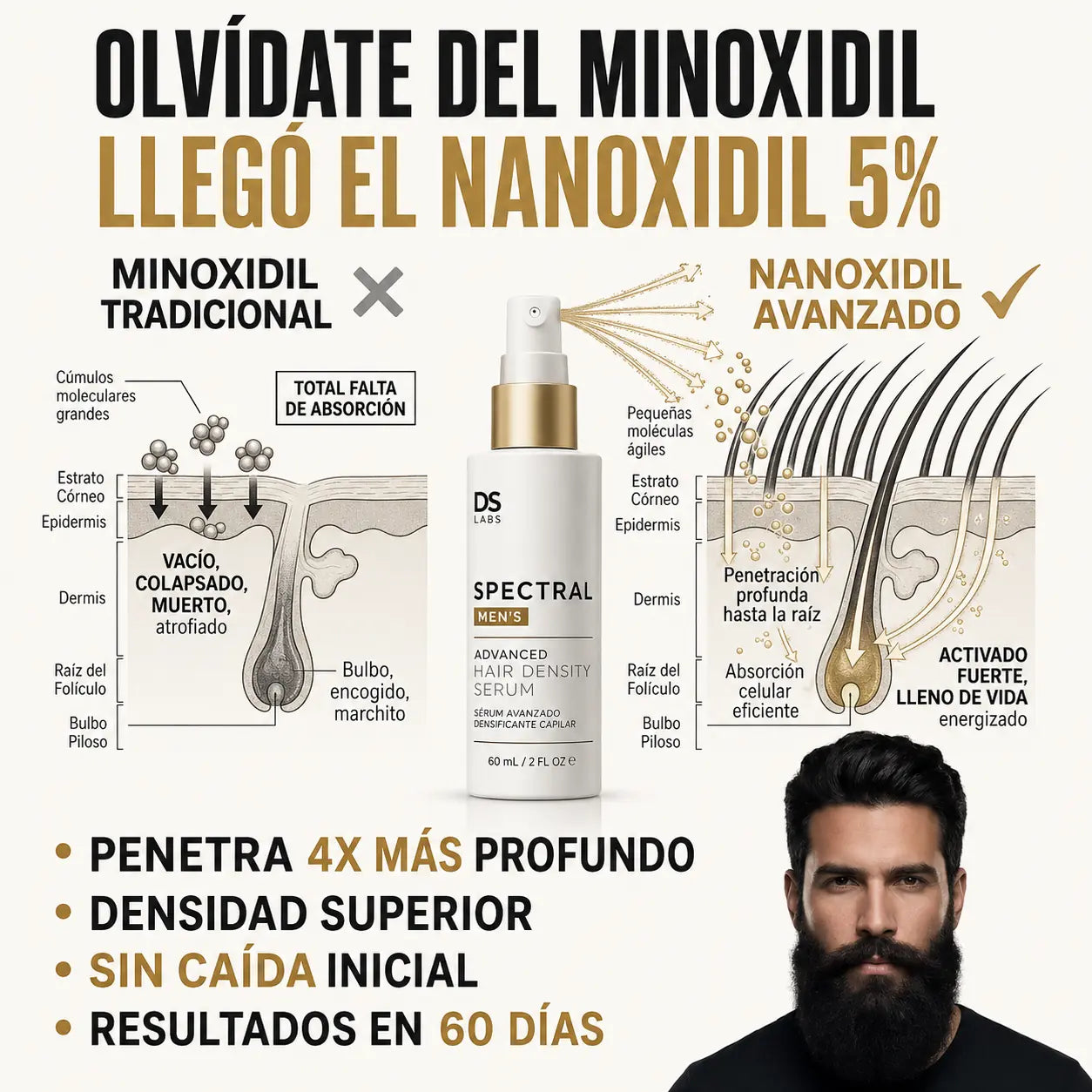 Nanoxidil