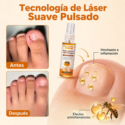 Spray reparador de uñas KaJota con veneno de abeja para fortalecer y reparar uñas dañadas, en envase con pulverizador.